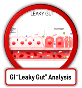 GI Leaky Gut Testing