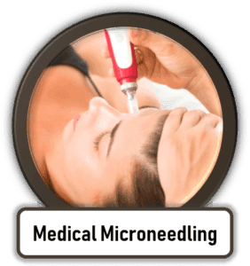 Microneedling