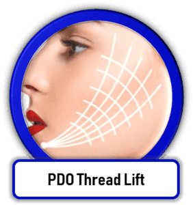 PDO Thread lift