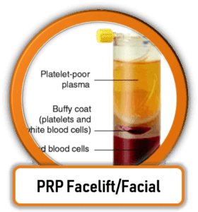 Cosmetic PRP Facelift and Facial