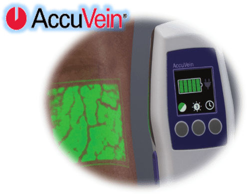 Accuvein device Accuvein laser vein treatment
