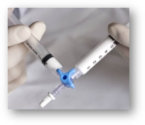 Foam 2 Foam Sclerotherapy Sotradecol
