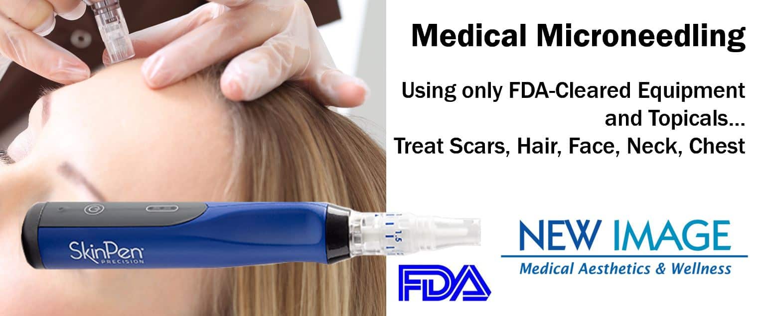 NI Microneedling Banner