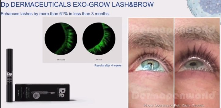 Exosome lash serum