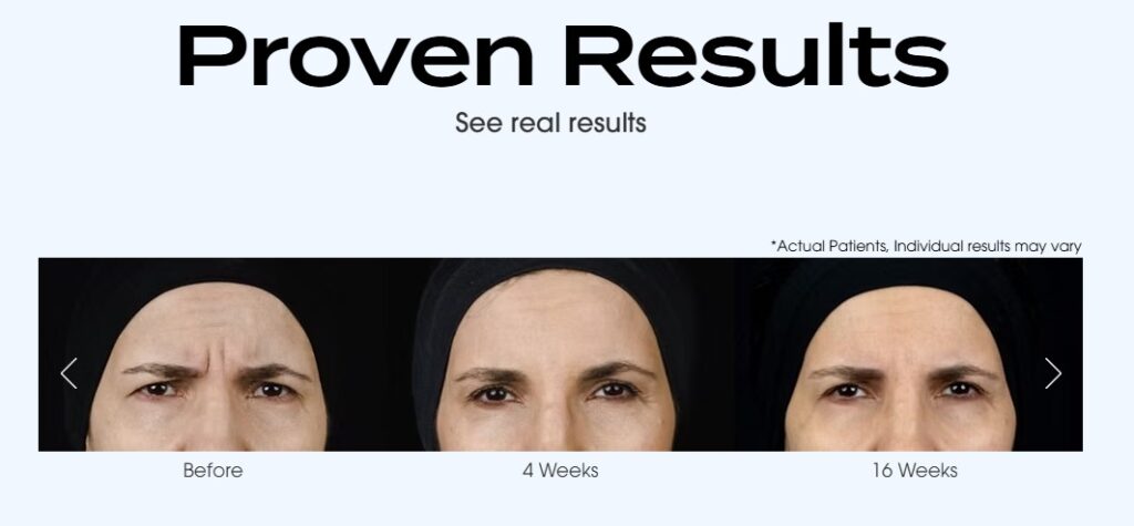 letybo brow results